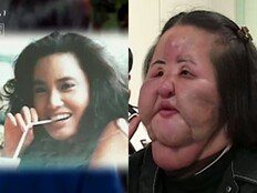 선풍기 아줌마 얼굴서 ‘공업용 실리콘→콩기름’ 4kg 나와 (꼬꼬무)[TV종합]