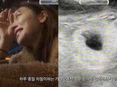 ‘임신 12주’ 김지영, 낙상 사고 당했다…“등이 갈리도록 넘어져”