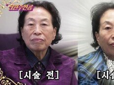 ‘87세’ 전원주, 500만 원 리프팅 시술…“10년만 젊어지고 싶다”