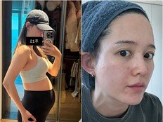 남보라 “임신 21주차, 호르몬의 노예”…피부 트러블 고백