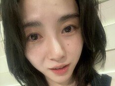 권민아 “가해자는 어디에?”…피부 시술 후 2도 화상 주장 [SD톡톡]