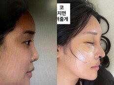 랄랄 맞아? 눈밑지+코 수술 후 확 달라진 근황…“착해진 거 같기도” [DA★]