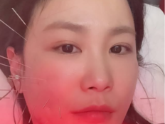 ‘♥김준호’ 김지민, 2세 준비 중 얼굴 함몰…“돌아오겠죠?”