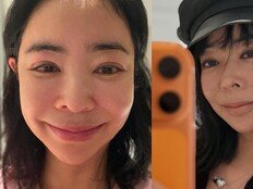 이혜영, ‘부은 얼굴’ 안타까운 근황…“내 목표 건강 회복” [DA이슈]