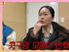 “콧구멍 변해” 백지영, 성형 10억설 고백…정석원 ‘연골 약속♥’ [DA클립]