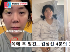 허안나, ‘박나래 여파’로 실직…차 사고·갑상선 수술까지 ‘악재’ (동상이몽2)