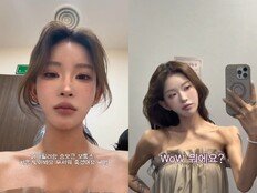 ‘최진실 딸’ 최준희, 어깨 필러+승모근 보톡스 “실시간 보정 신기해”