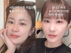 김지민, 시험관 시술 후 3.5kg 증가…“♥김준호가 마사지 해줘” [DA★]