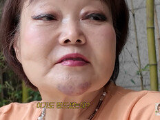 이혜정, 얼굴 멍에 손 상처까지…“처량하게 쳐다보지 마” [DA클립]