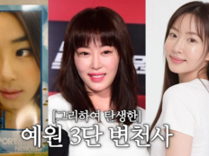 “성형 이야기 이제 그만”…강예원, 코 성형까지 밝혔다