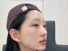 ‘故최진실 딸’ 최준희 “18살부터 입술 필러 맞았다”…시술 과정 공개