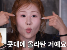 박세미, 코 구축→눈까지 몰렸다…“앞꼬리가 콧대 올라타 재건 수술”