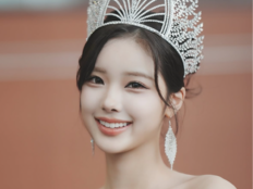 미스코리아 성형 논란에 정연우 입 열었다…“성형 안 했고 시술은 여러 번”