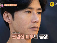 오종혁, ‘귤껍질 피부’ 감추려 두꺼운 화장…오히려 악순환