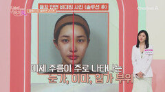 안면 비대칭을 맞춘 율희 맞춤 터치 솔루션의 정체는?