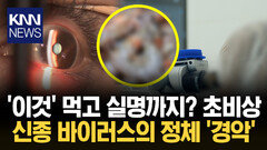 염증 생기더니…＂앞이 안 보여요?＂ 중국발 미스테리 눈병 확산 ′패닉′ / KNN