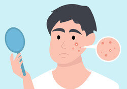 여드름 잘 나는 피부엔 약산성 세안용품이 적합