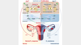 차 의과학대학 연구팀, 자궁내막증 유발하는 후성 유전학적 조절 과정 규명