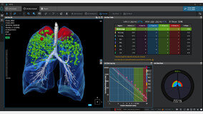 [서울형 R&D] 코어라인소프트 이재연 부사장 “CT 영상 속 데이터를 분석합니다”