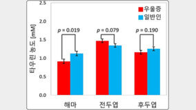 KBSI “??? ??? ?? ??? ?? 20% ??”