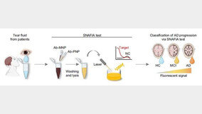 “눈물로 알츠하이머병 조기 진단한다”…고통·비용 절감 기대