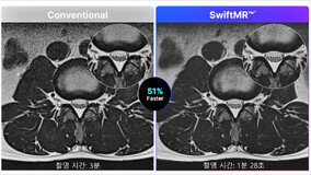 [????-ing] MRI ?? ?? ????? ?? ?? ??? ‘??????’