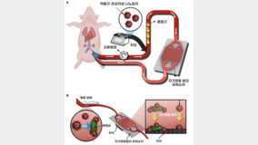 패혈증 원인균, 자석으로 제거…체외 혈액 정화기술 개발