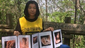 “18년 넘게 가습기살균제 쓰며 5번 유산…관련성 인정돼야”