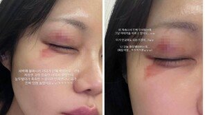 ‘Yoo Sang-moo♥’ Kim Yeon-ji, bruised and swollen, rushed to the emergency room… Terrible at dawn [DA★]