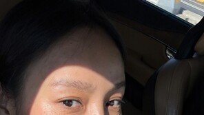 Hyori Lee, confident with wrinkles and blemishes… Natural beauty without decoration [DA★]