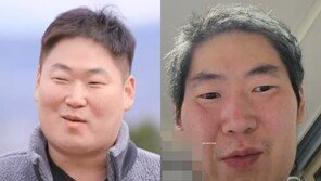 19th Youngcheol, shocking recent situation in video… Traces of intubation [DA:Issue]