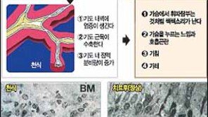 [일반건강]열명중 두명꼴 천식증세