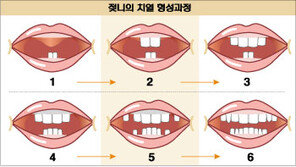 [어린이 건강]젖니, 소홀히 했다간 만성 치아질환