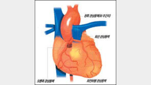 [건강 100세 ABC]<11>심장동맥질환