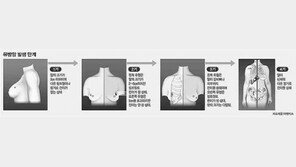 [건강]유방암 재발률 낮춘 새 치료법 각광