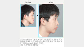 [헬스&뷰티]이미지 성형시대