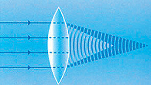 [헬스&뷰티]다초점 인공수정체 삽입법 개발