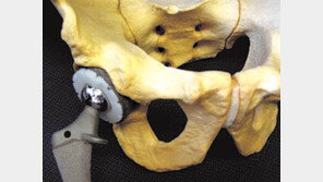 [달콤 살벌한 방사선]방사선이 만든 희망들