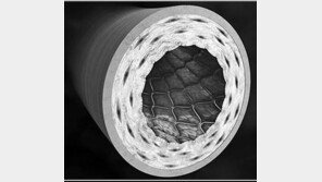 “혈관확장술 협심증 치료… 약물투여와 별차이 없다”