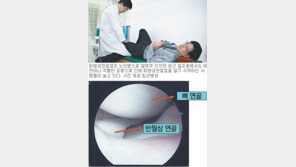 [헬스&뷰티]조기치료 놓치면 평생 무릎 고통
