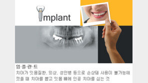 [헬스&뷰티]하얀 미소…힘찬 젊음…맞춤형 임플란트가 온다