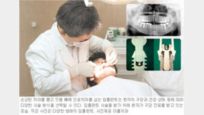 [헬스&뷰티]똑똑해진 임플란트… 어떤 환자든 문제없어요