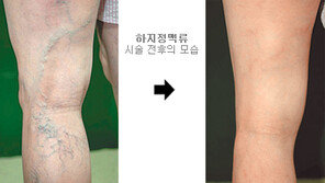 [헬스&뷰티]부모님 다리가 무겁고 쥐가 난다고요?