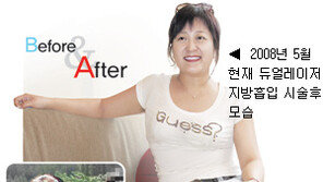 [Prime TOWN]Before & After/빠지지 않던 뱃살