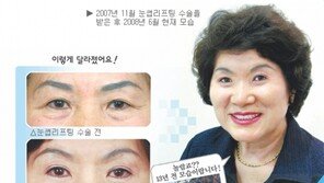 [건강]박 여사가 10년 젊어진 비밀은?