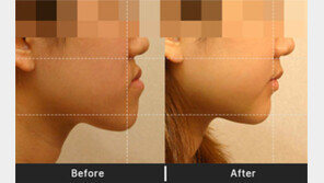 불황 속에 아름다운 스마일이 더 중요하다