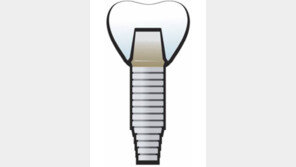 [헬스&뷰티]치간칫솔-치실로 청결 꼼꼼히 싹싹∼