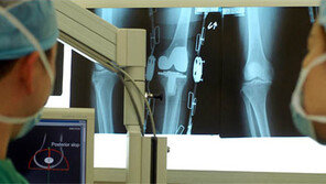 인공관절 수술, 네비게이션 이용한 길 찾기!