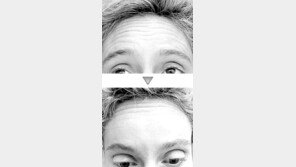 [헬스&뷰티]보톡스는 어떤 주름에도 OK?