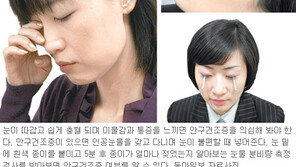 [헬스&뷰티]노래진 흰자위→간에 ‘빨간불’